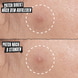 Truly Targeted Overnight Blemish Patch