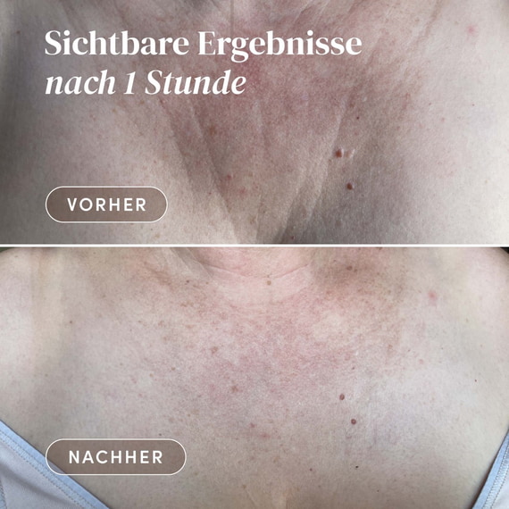 Wiederverwendbares Dekolleté Pad mit Ectoin