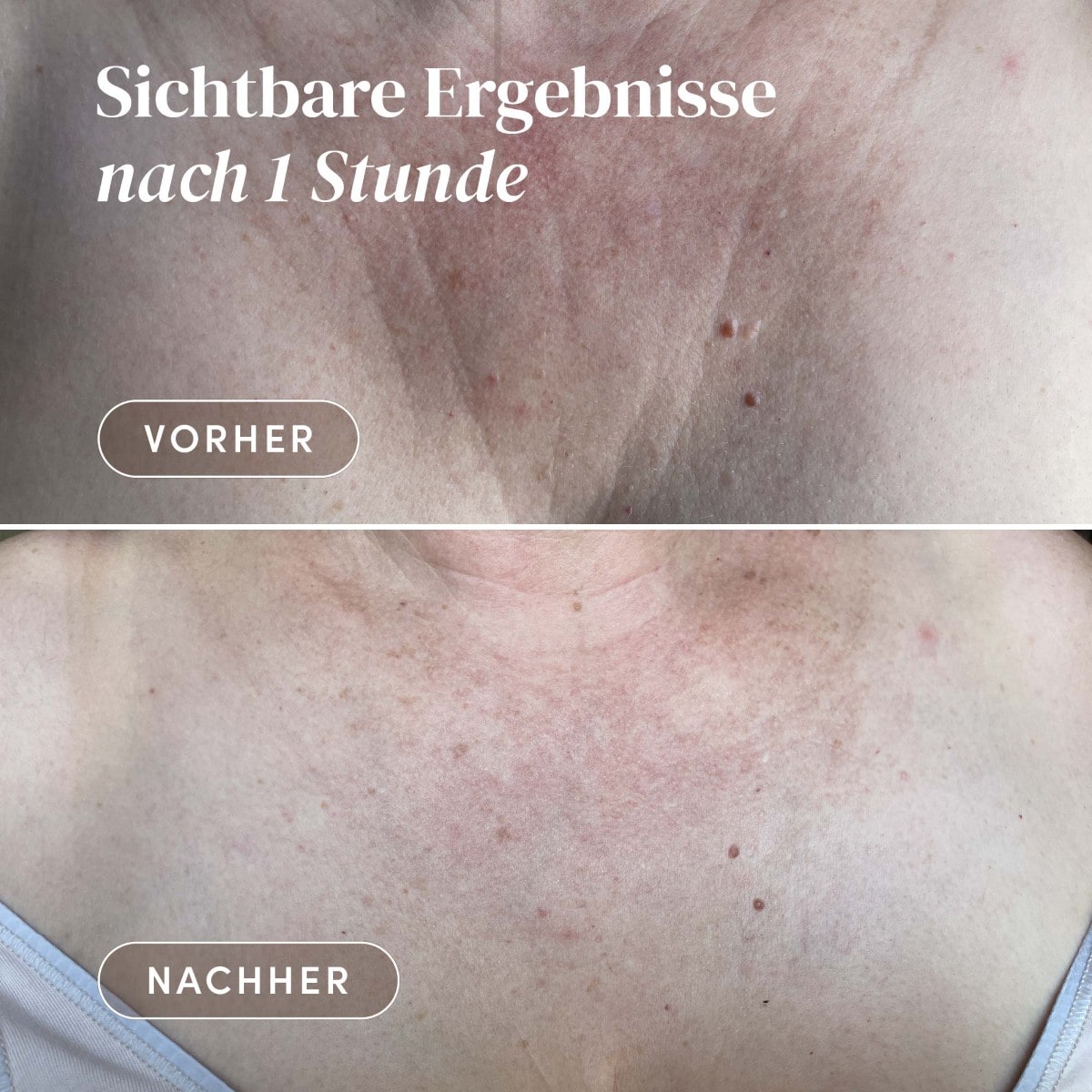 Wiederverwendbares Dekolleté Pad mit Ectoin