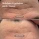 Gesicht Patches mit Aloe Vera