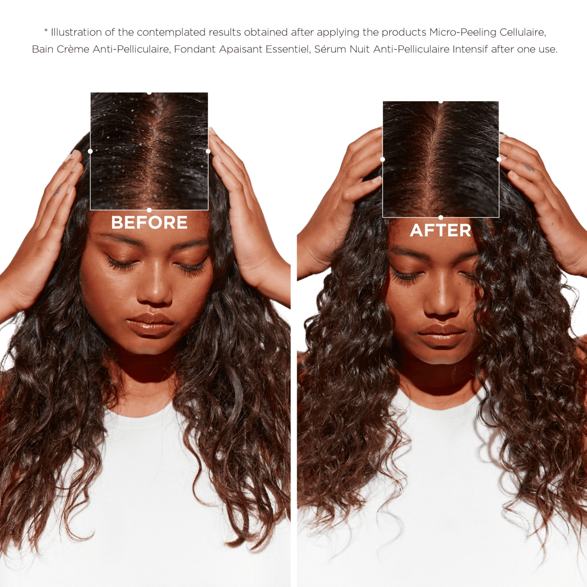 Micro-Peeling Cellulaire