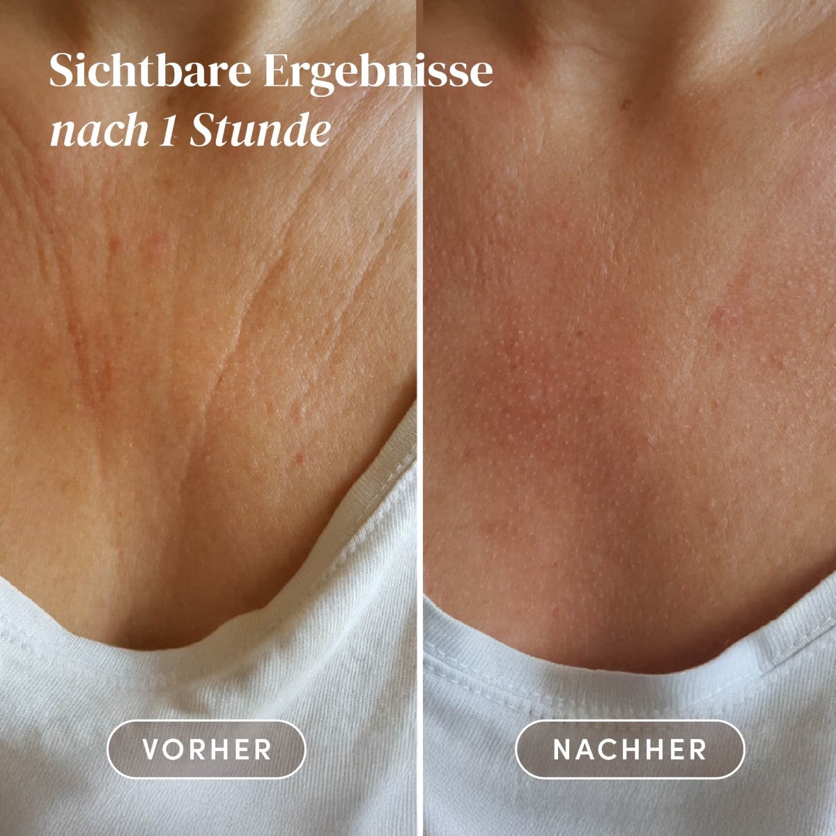 Wiederverwendbare Décolleté Pads mit Vitamin C