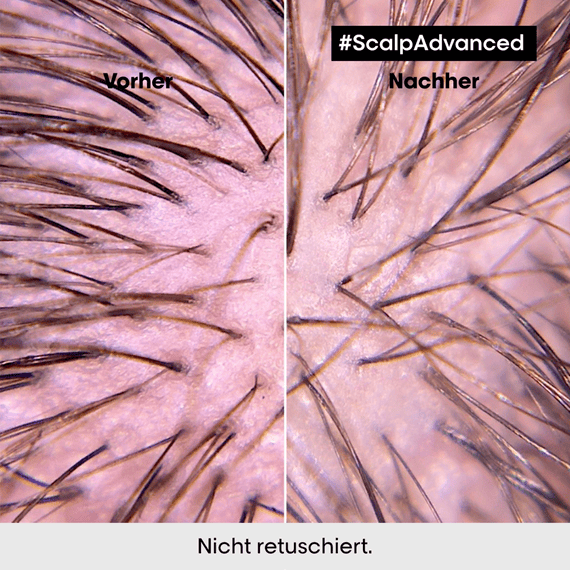 Scalp Advanced Anti-Discomfort Intese Soother Treatment