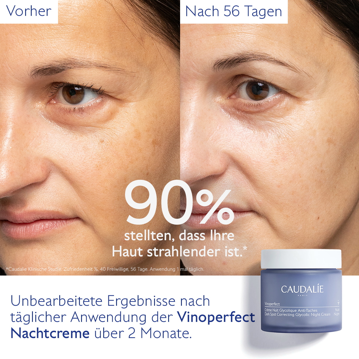 Anti-Pigmentflecken Glykol-Nachtcreme - Nachfüllpackung