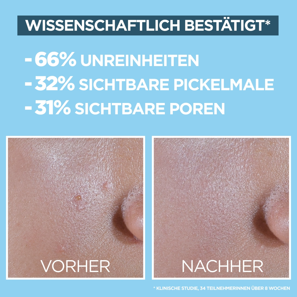 BHA + Niacinamide Daily-UV Anti-Imperfections Fluid Invisible + Matt SPF 50+