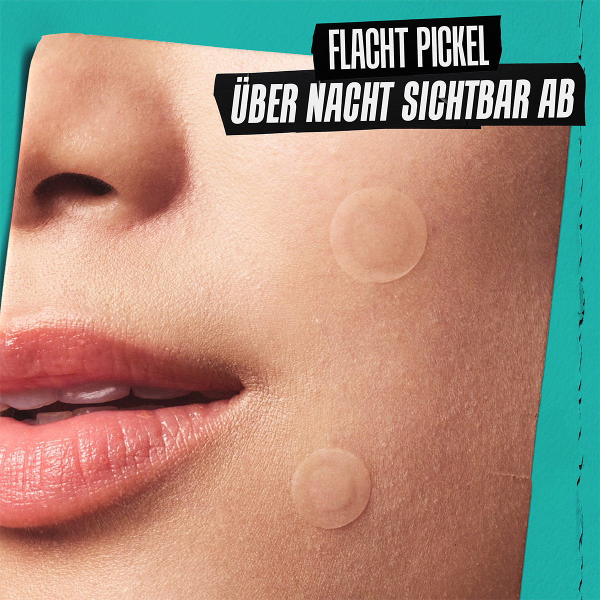 Truly Targeted Overnight Blemish Patch