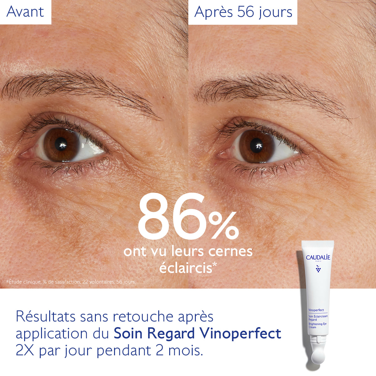 Soin Éclaircissant Regard