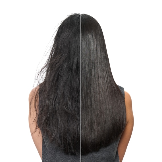 Anti-Hairfall Serum