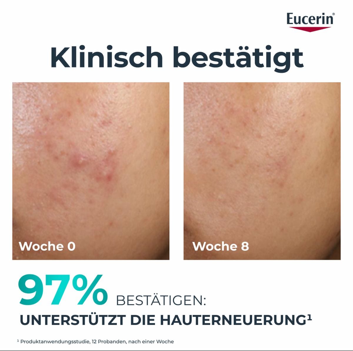 Clinical Hautbilderneuernde Nachtpflege