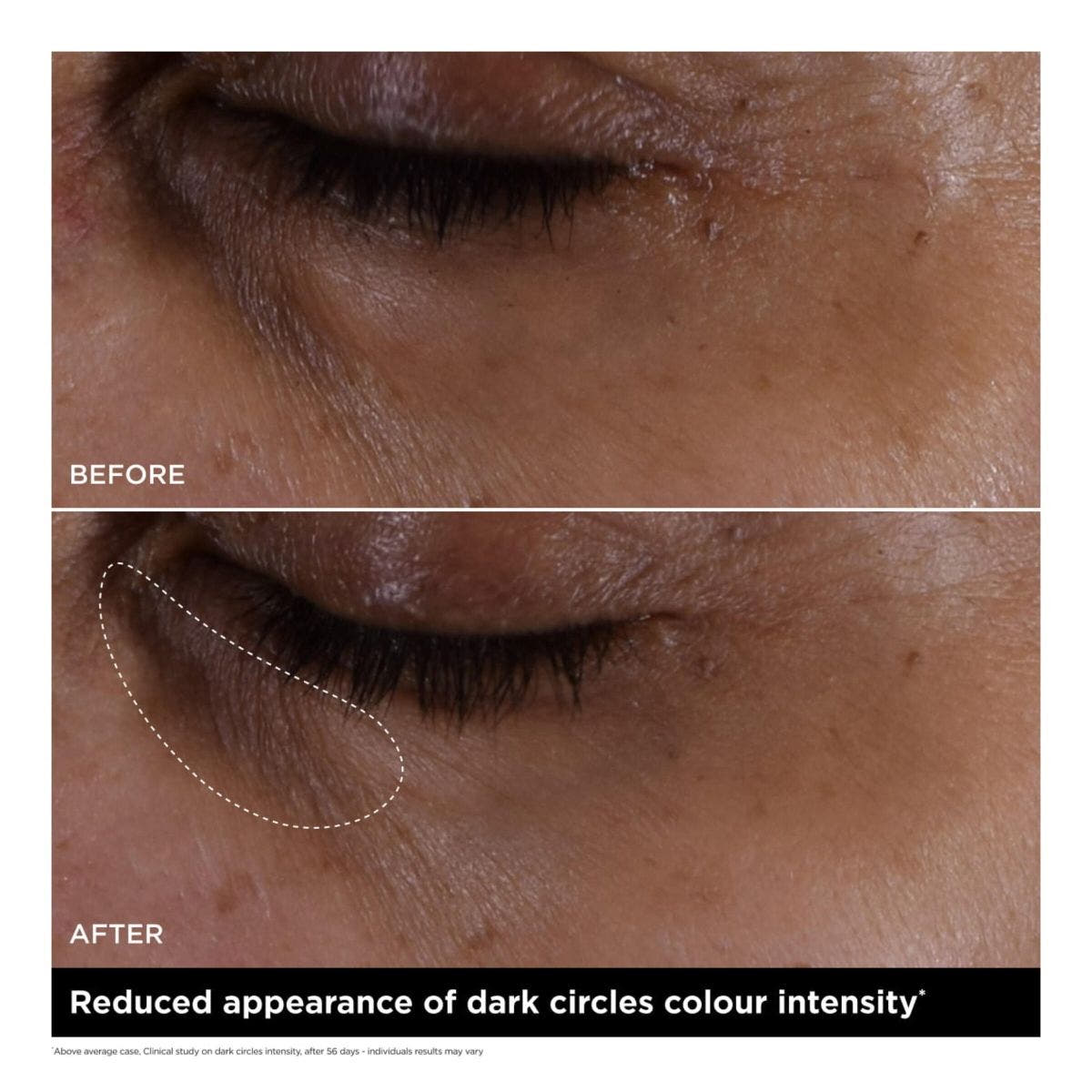 Double Serum Eye