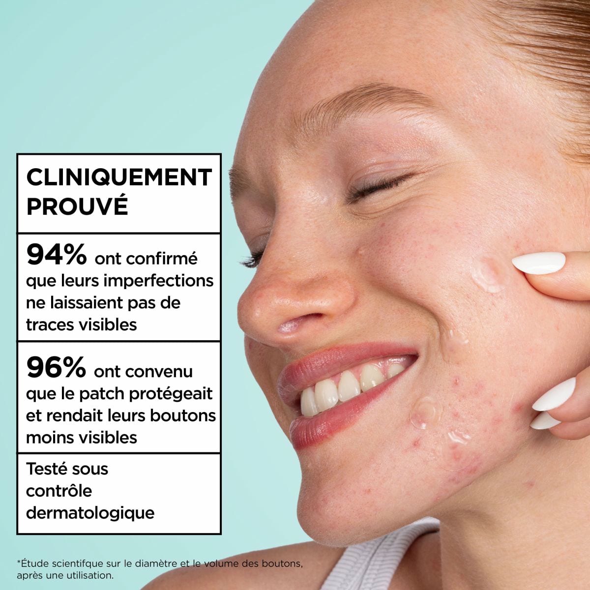Salicylic Ultra Power Pimple Patch