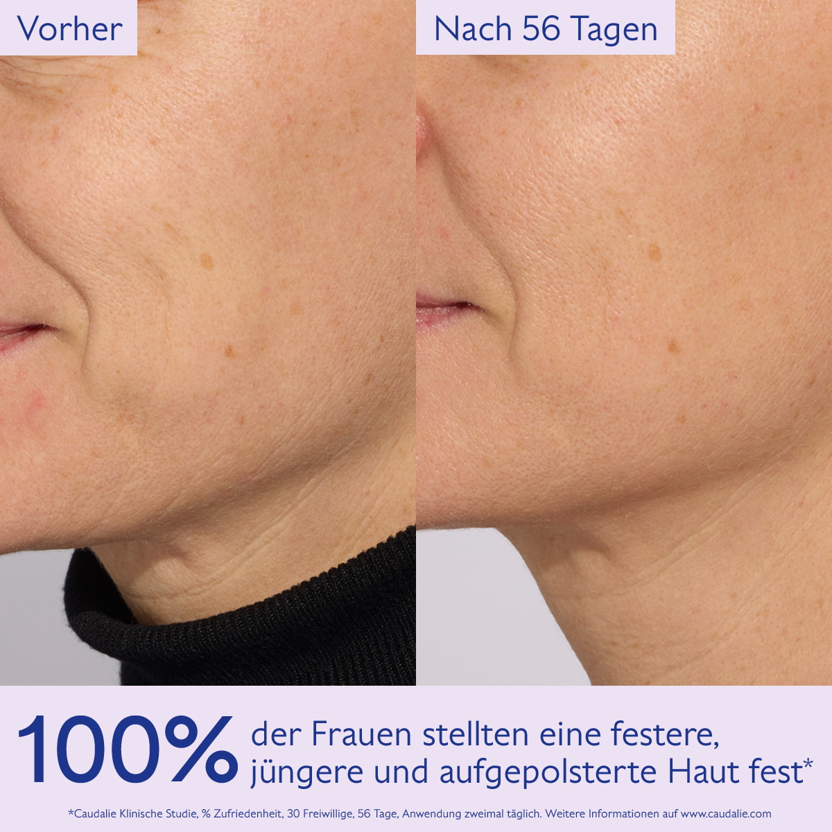 Lifting Straffungsserum