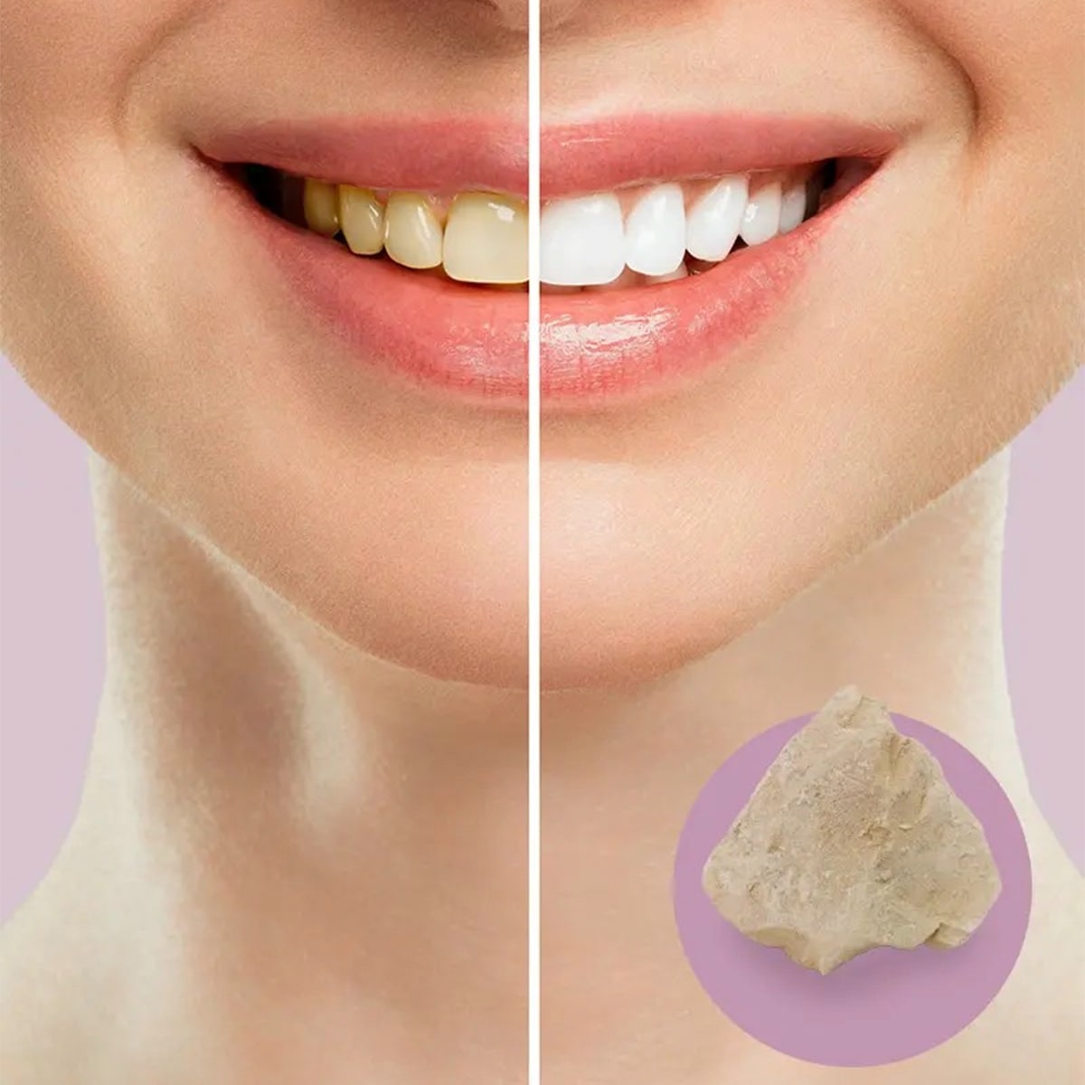 Clean & Polish Paste Tooth Cleaning