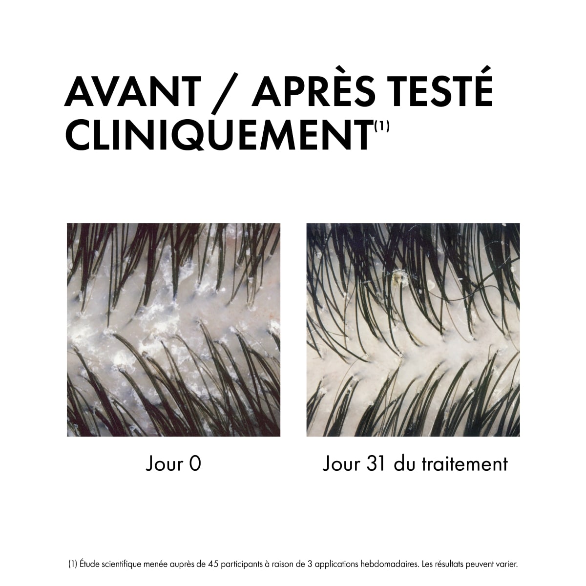 Anti-pelliculaire 2en1 Shampooing & Après-shampooing