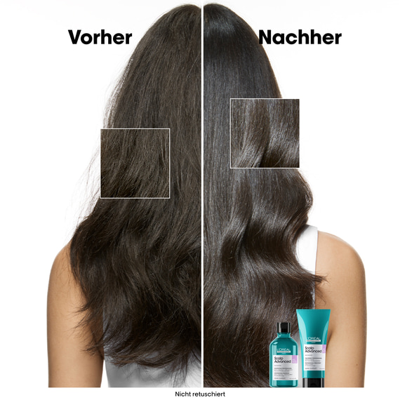 Scalp Advanced Anti-Discomfort Dermo-Regulator Shampoo