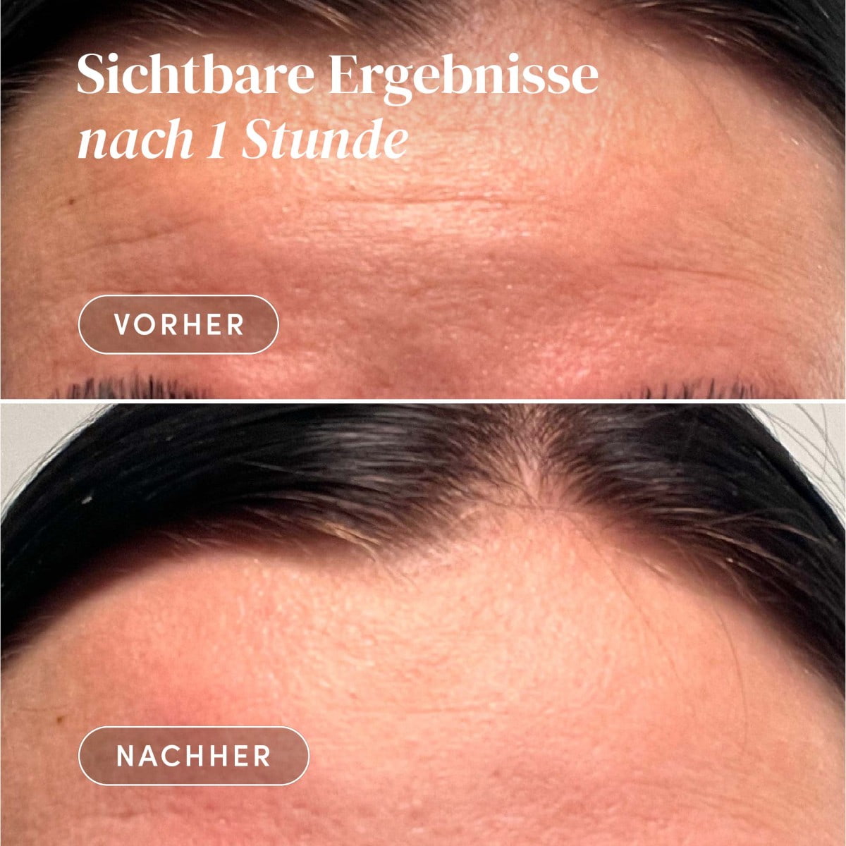 Wiederverwendbares Stirn Pad mit Aloe Vera