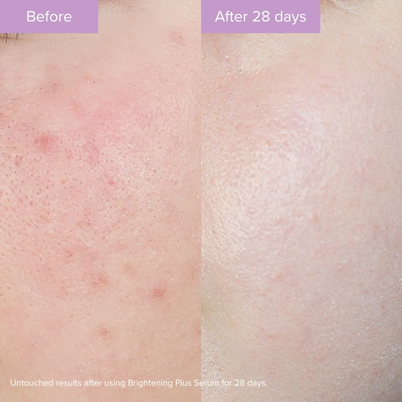 Brightening Plus Serum