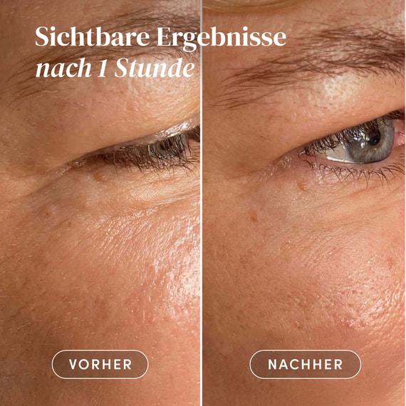 Wiederverwendbare Augen-Schläfen Pads mit Aloe Vera