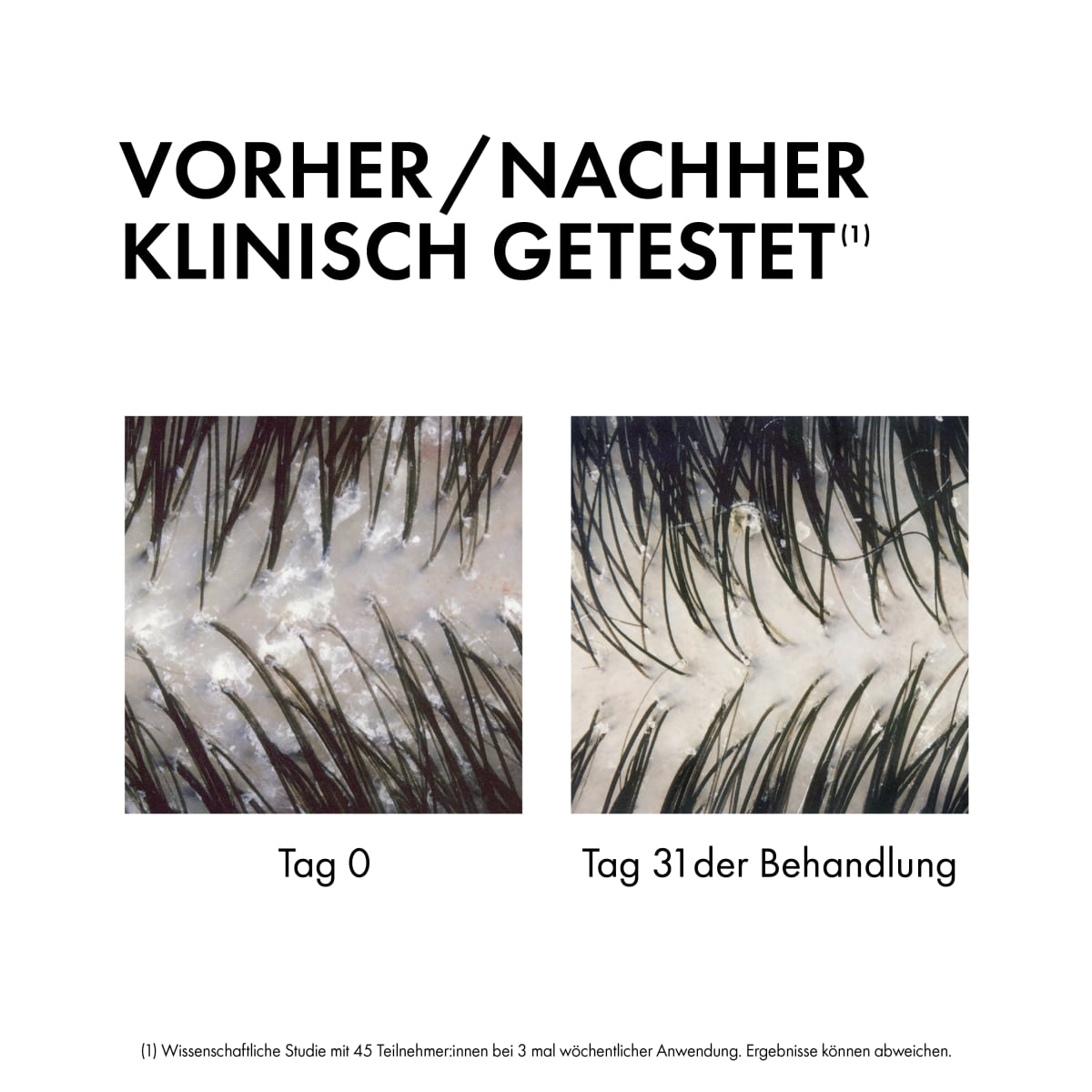 Anti-Schuppen 2in1 Shampoo & Pflegespülung