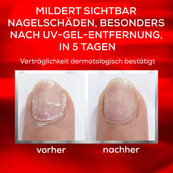 To the rescue Nagelpflege reparierender Nagellack
